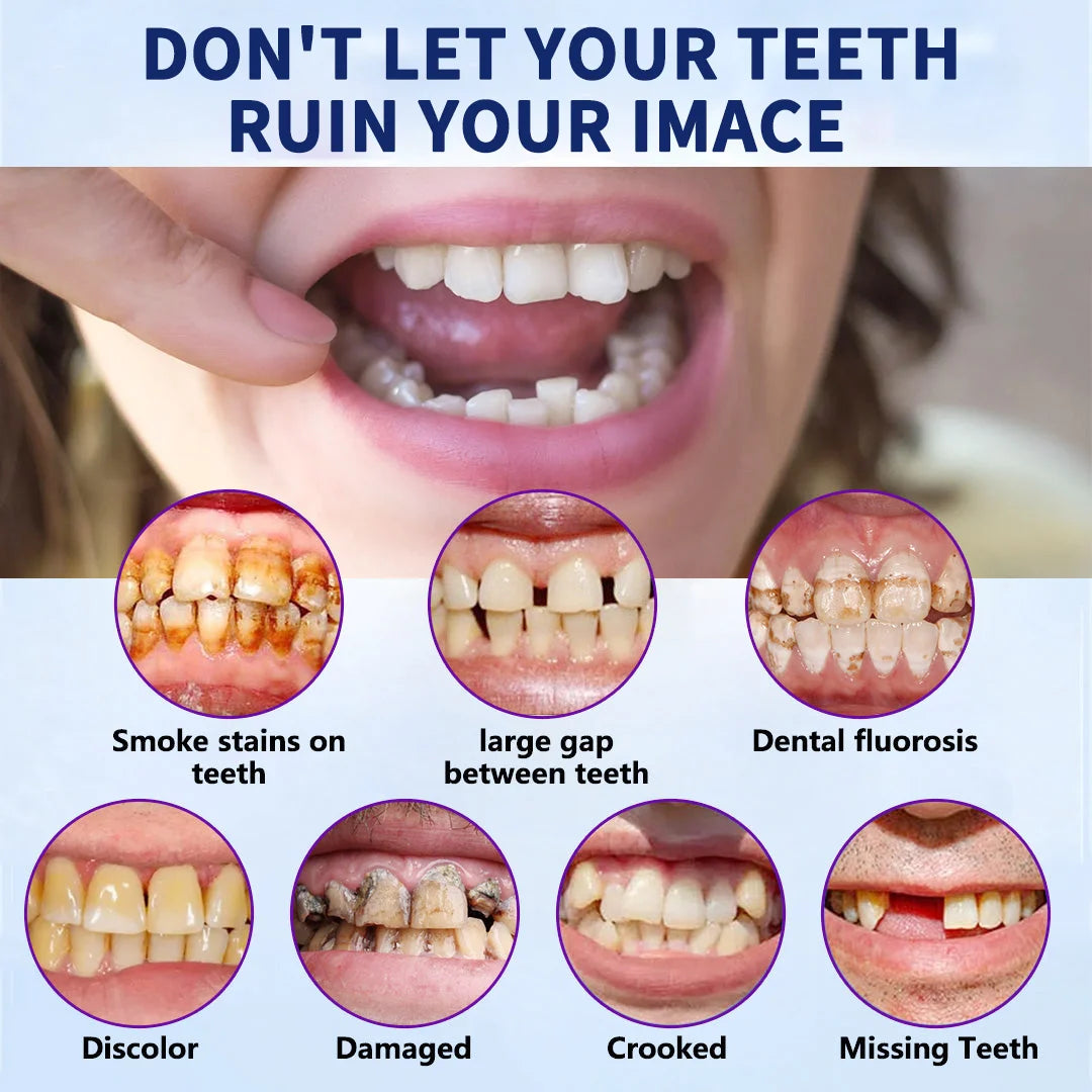 NESLEMY™-🦷Advanced Customized Full Denture Set🦷——Self-adsorbed in the mouth, comfortable to wear, worry-free chewing——your exclusive denture solution  (⏰Limited time discount last 30 minutes⏰)