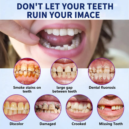 NESLEMY™-🦷Advanced Customized Full Denture Set🦷——Self-adsorbed in the mouth, comfortable to wear, worry-free chewing——your exclusive denture solution  (⏰Limited time discount last 30 minutes⏰)