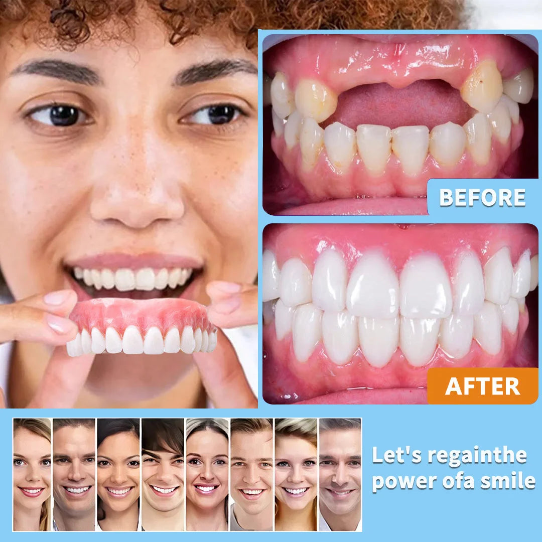 NESLEMY™-🦷Advanced Customized Full Denture Set🦷——Self-adsorbed in the mouth, comfortable to wear, worry-free chewing——your exclusive denture solution  (⏰Limited time discount last 30 minutes⏰)